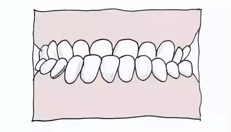 Con gái lúc nhỏ đẹp nhưng càng lớn càng móm, đến bệnh viện bác sĩ nói nguyên nhân khiến gia đình suy sụp - 3