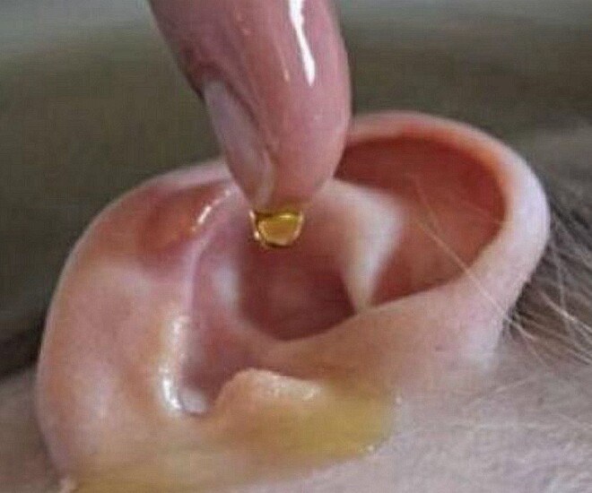 Con gái mẫu giáo bị sinh vật lạ chui vào tai, chỉ với một hành động người mẹ được bác sĩ khen “Rất thông minh” - 1