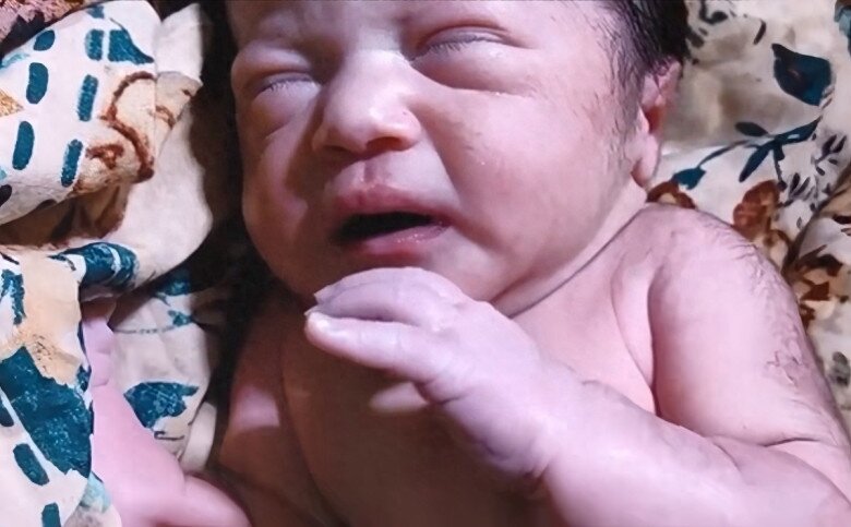 Con sơ sinh chào đời 7 ngày vẫn chưa mở mắt, tưởng con gặp vấn đề mẹ liền đưa đến bệnh viện, kết quả không ngờ - 2