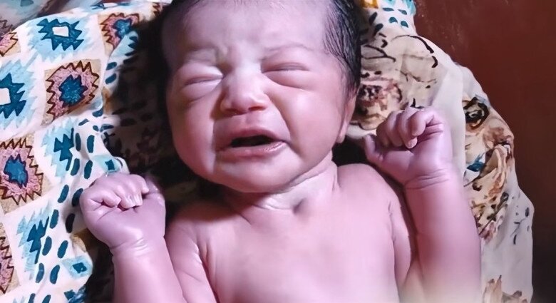 Con sơ sinh chào đời 7 ngày vẫn chưa mở mắt, tưởng con gặp vấn đề mẹ liền đưa đến bệnh viện, kết quả không ngờ - 3