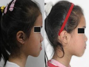 Yêu con - Con gái lúc nhỏ đẹp nhưng càng lớn càng móm, đến bệnh viện bác sĩ nói nguyên nhân khiến gia đình suy sụp