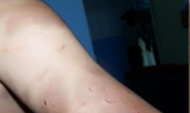 Người mẹ phát hiện con 1 tuổi cứ được anh trai bế là khóc thét, lúc kiểm tra cơ thể đứa trẻ, mẹ mới tá hoả - 2