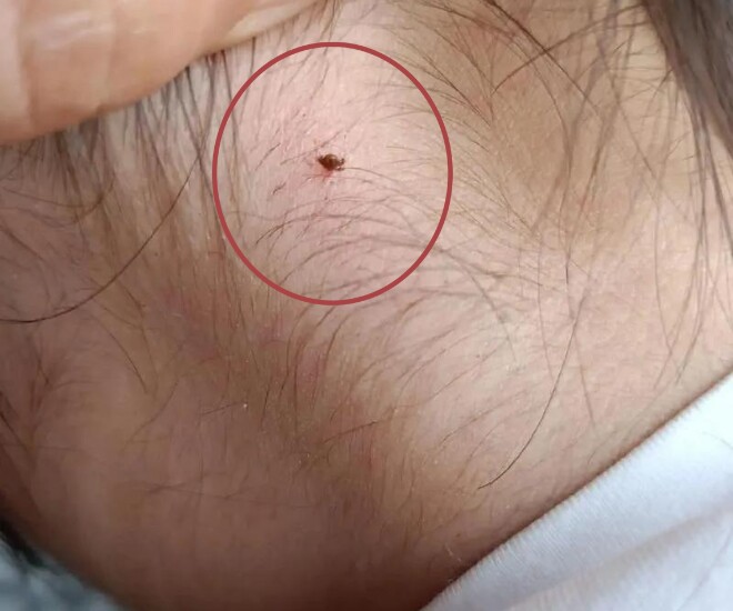 Phát hiện sinh vật lạ cắn vào cổ con gái 4 tuổi, người mẹ vẫn “từ chối” hai lần cứu con và cái kết không ngờ - 1