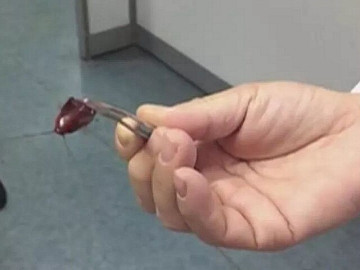 Con gái mẫu giáo bị sinh vật lạ chui vào tai, chỉ với một hành động người mẹ được bác sĩ khen Rất thông minh