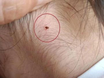 Phát hiện sinh vật lạ cắn vào cổ con gái 4 tuổi, người mẹ vẫn từ chối hai lần cứu con và cái kết không ngờ