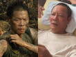 Chuyện đời 2 diễn viên cùng tên Thái Hòa: Người từng bị trầm cảm da tróc từng mảng, người nằm liệt giường không tiền chữa bệnh