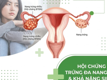 Bà bầu - 4 cách cải thiện khả năng sinh sản ở phụ nữ mắc Hội chứng buồng trứng đa nang