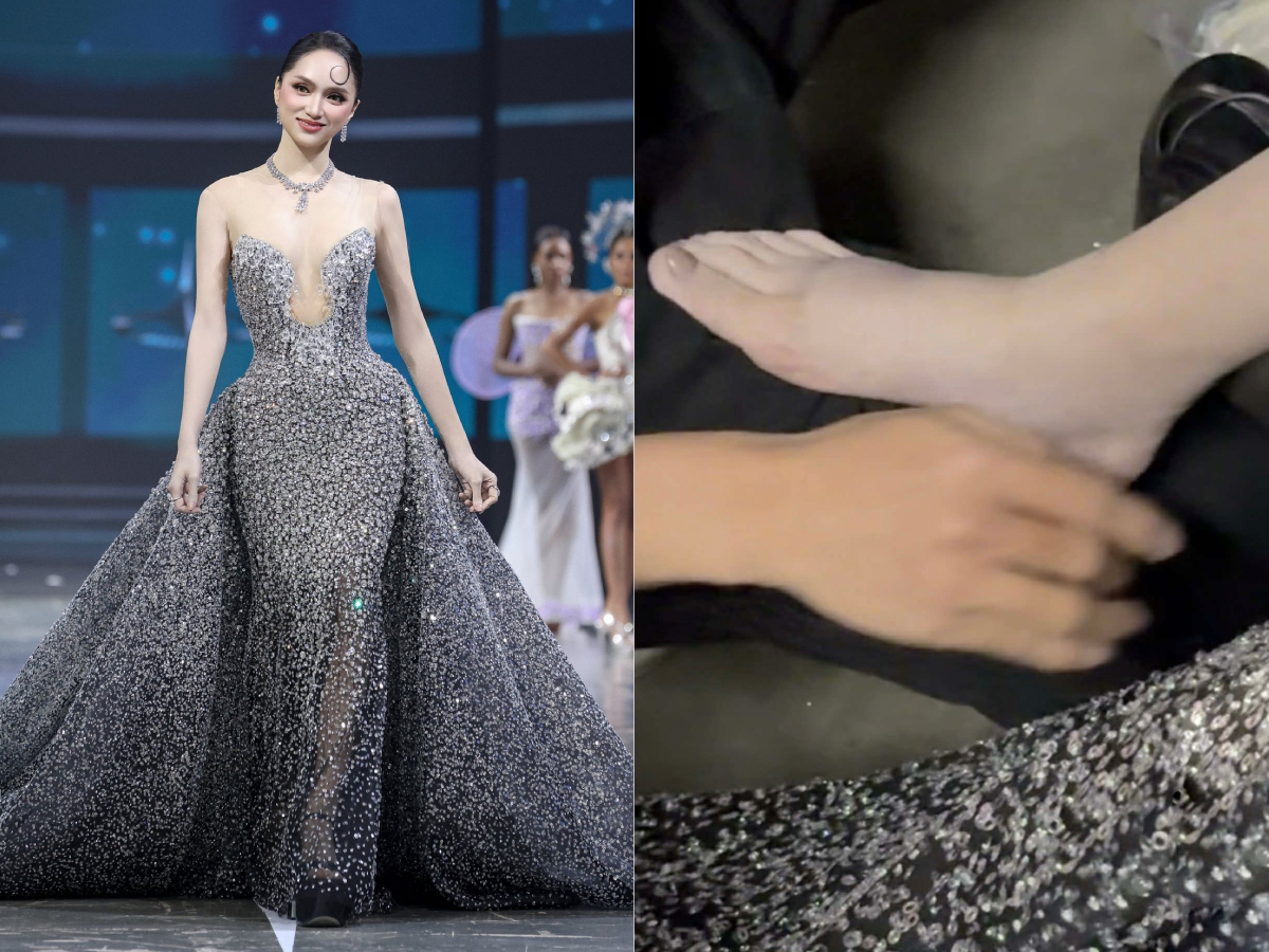 Sau đêm mở màn ở MGI All Stars hôm 19/5, chuyên gia trang điểm của Hương Giang chia sẻ đôi chân sưng phù của cô. Tình trạng này Hương Giang gặp phải từ trước lúc tham dự cuộc thi khoảng một tuần, tuy nhiên người đẹp vẫn cố gắng diện giày cao gót tôn dáng.