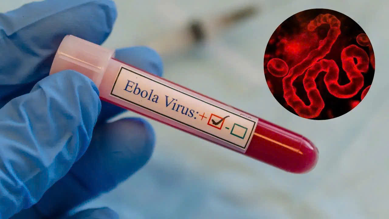 Trước diễn biến phức tạp của dịch bệnh Ebola tại Congo và Uganda, Thứ trưởng Bộ Y tế Nguyễn Thị Liên Hương đề nghị các địa phương và hệ thống Viện Vệ sinh dịch tễ/Pasteur tăng cường giám sát, phát hiện sớm ca nghi ngờ, chủ động triển khai đồng bộ các biện pháp phòng chống nhằm ngăn chặn nguy cơ dịch bệnh xâm nhập vào Việt Nam...