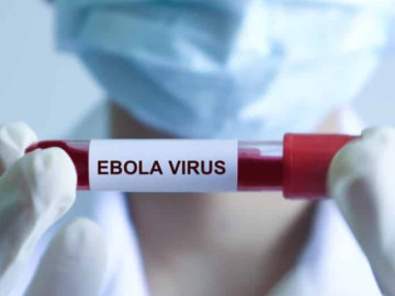 Tỉ lệ tử vong do Ebola có thể lên đến 90%, Bộ Y tế nêu các triệu chứng thường gặp khi mắc bệnh
