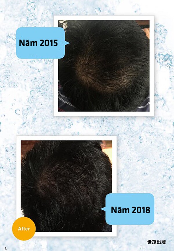 Sự thay đổi mái tóc của chuyên gia sau thời gian dài dùng nước muối gội đầu.