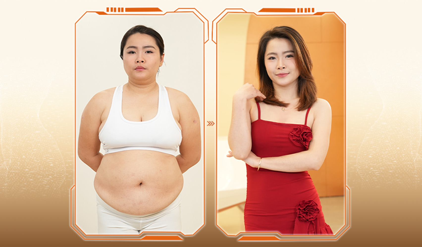 Liệu trình giảm béo Lipomed tại Bệnh viện Tạo hình Thẩm mỹ Dr.Hải Lê hướng đến kiểm soát cân nặng và cải thiện vóc dáng theo chuẩn y khoa.