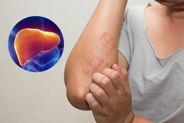 Gan đóng vai trò quan trọng trong quá trình thanh lọc cơ thể