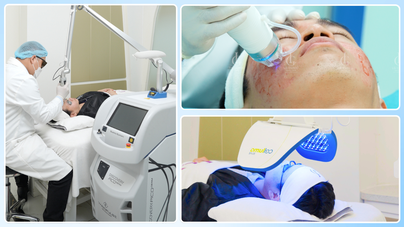 Phòng khám Da liễu LG hiện đang ứng dụng hệ thống công nghệ điều trị sẹo rỗ tiên tiến nhất hiện nay
