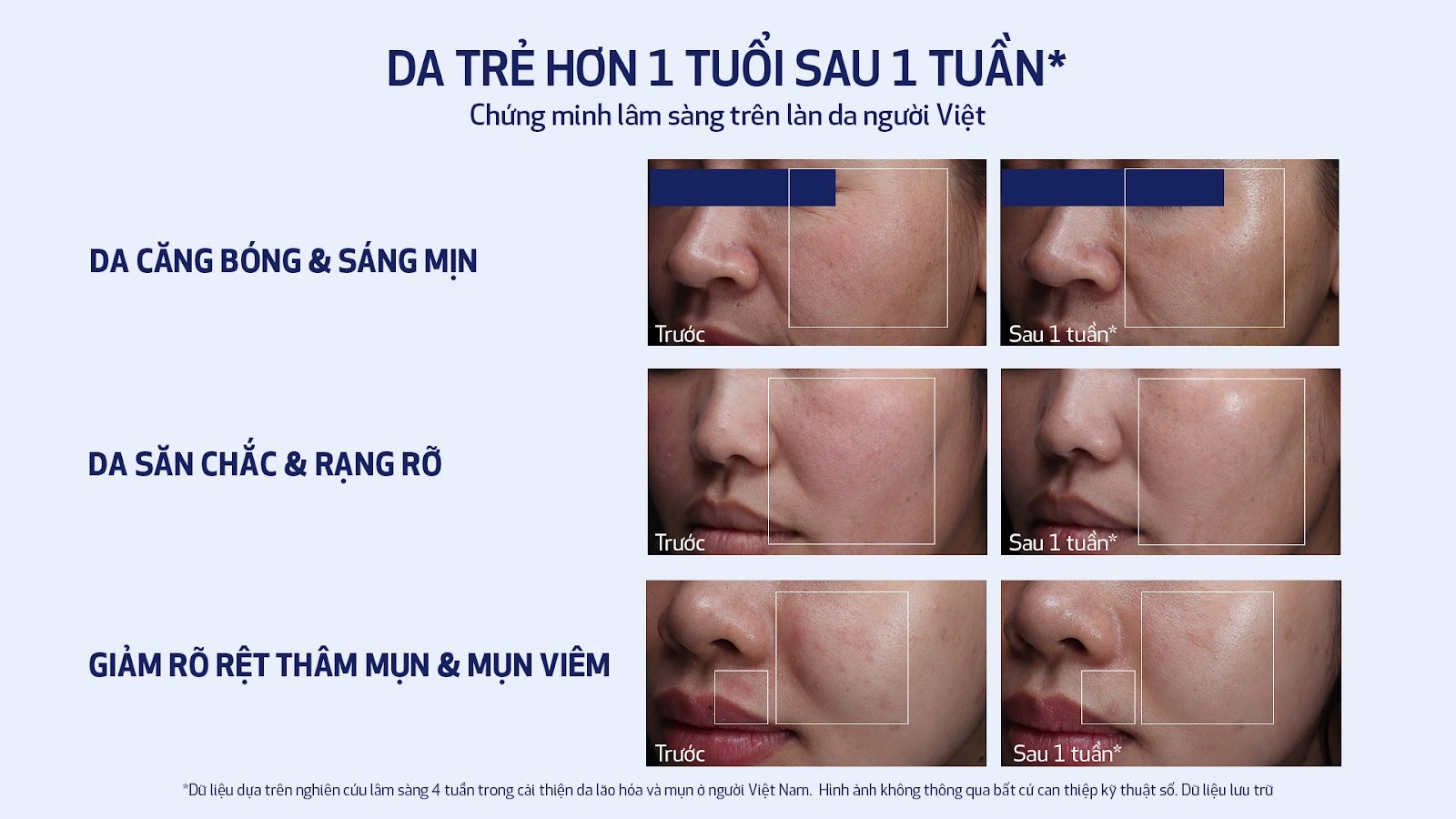 Obagi Nu-Gen™ đạt hiệu quả thực tế, da trẻ hơn 1 tuổi nhanh chóng chỉ sau 1 tuần