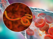 Sức khỏe - WHO báo động khẩn về Ebola, đáng ngại đến đâu, cần làm gì để phòng tránh?