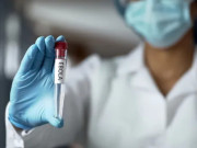 Sức khỏe - Vì sao WHO đánh giá nguy cơ Ebola vào Việt Nam ở mức thấp?