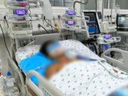 Sức khỏe - Nắng nóng, thiếu niên 15 tuổi sốc nhiệt nguy kịch, tổn thương gan, thận khi chơi thể thao