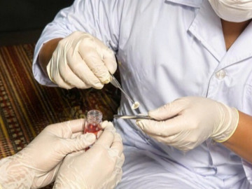 Sức khỏe - Ca hiến giác mạc đầu tiên tại Bệnh viện Đa khoa Bắc Ninh số 1