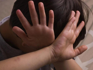 Cháu bé bầm tím khắp người ở Nghệ An: Công an vào cuộc xác minh