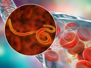 WHO báo động khẩn về Ebola, đáng ngại đến đâu, cần làm gì để phòng tránh?