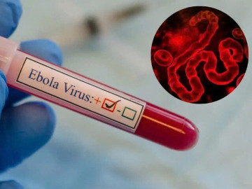 WHO cảnh báo khẩn về Ebola, Bộ Y tế yêu cầu tăng cường giám sát, ngăn dịch xâm nhập