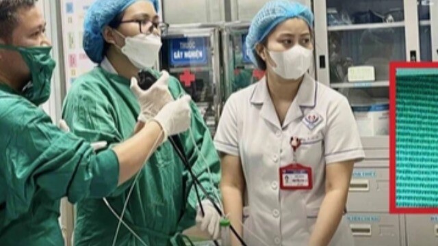 Hiếm gặp: Ăn cá biển, người đàn ông bị lưỡi câu mắc sâu trong thực quản