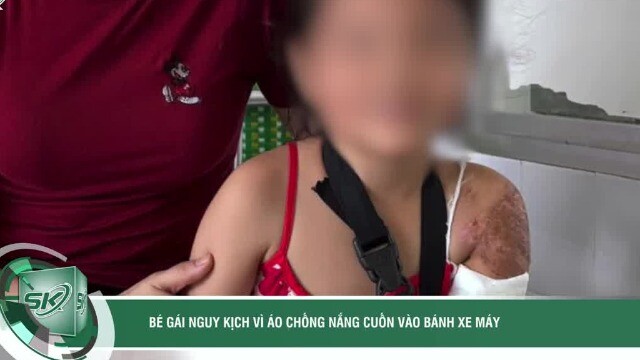 Bé gái nguy kịch vì áo chống nắng cuốn vào bánh xe máy, đứt động mạch cánh tay