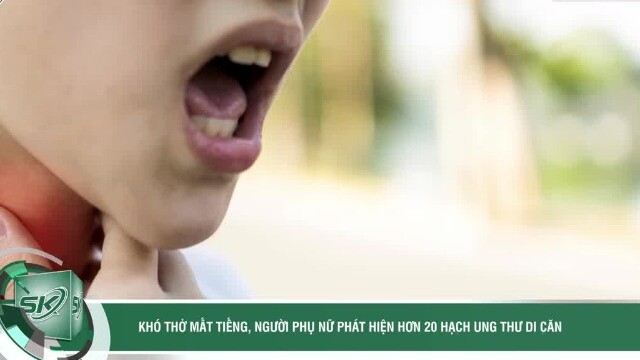Khó thở mất tiếng, người phụ nữ phát hiện hơn 20 hạch ung thư di căn
