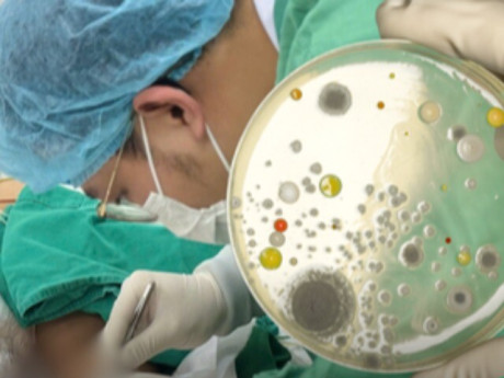 Đau đầu nhiều ngày, người phụ nữ bất ngờ phát hiện nấm nguy hiểm trong não