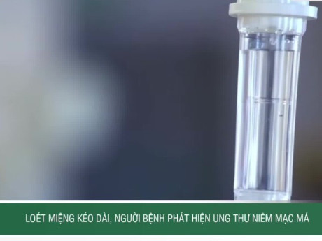 Loét miệng kéo dài, người bệnh phát hiện ung thư niêm mạc má