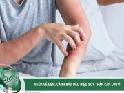 Clip Eva - Nhiều người ngứa dai dẳng tưởng dị ứng, đi khám mới 'ngã ngửa' vì suy thận nặng