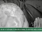 Clip Eva - Bé gái 14 tuổi bụng to như bầu 9 tháng, bác sĩ phát hiện u khủng