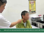 Clip Eva - Ngứa suốt nửa năm, người đàn ông phát hiện nhiễm cùng lúc 5 loại ký sinh trùng