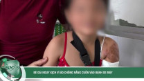 Bé gái nguy kịch vì áo chống nắng cuốn vào bánh xe máy, đứt động mạch cánh tay