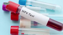 Có phải HPV dương tính là bị ung thư cổ tử cung không?
