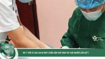 Bé 7 tuổi ở Lào Cai bị máy cuốn dập nát bàn tay do nghịch máy bào quế tự chế