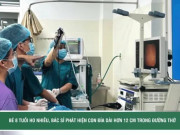 Clip Eva - Bé 8 tuổi ho nhiều, bác sĩ phát hiện con đỉa dài hơn 12 cm trong đường thở