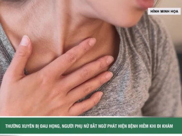 Thường xuyên bị đau họng, người phụ nữ bất ngờ phát hiện bệnh hiếm khi đi khám