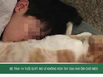 Bé trai 14 tuổi suýt mù vì không rửa tay sau khi ôm chó mèo
