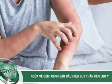 Nhiều người ngứa dai dẳng tưởng dị ứng, đi khám mới 'ngã ngửa' vì suy thận nặng