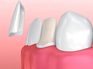 Kỳ 3: Răng sứ không hóa đơn, tiền về tay ai?