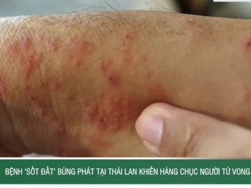 Bệnh ‘sốt đất’ bùng phát tại Thái Lan khiến hàng chục người tử vong