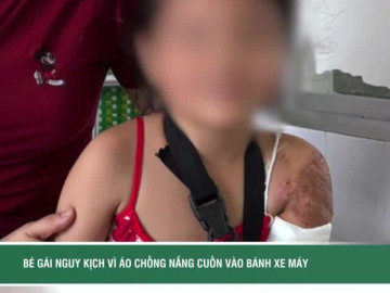 Bé gái nguy kịch vì áo chống nắng cuốn vào bánh xe máy, đứt động mạch cánh tay