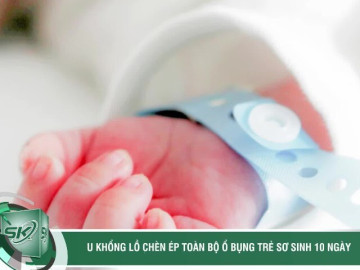Cứu trẻ sơ sinh 10 ngày tuổi mang khối u hiếm gặp, chèn ép toàn bộ ổ bụng