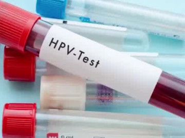 Có phải HPV dương tính là bị ung thư cổ tử cung không?