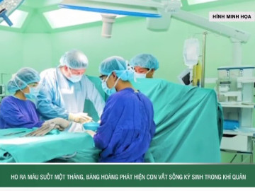 Ho ra máu suốt một tháng, bàng hoàng phát hiện con vắt sống ký sinh trong khí quản