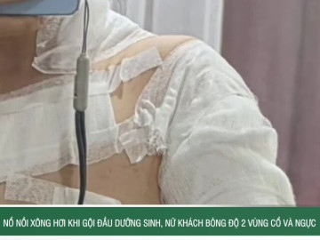 Nổ nồi xông hơi khi gội đầu dưỡng sinh, nữ khách bỏng độ 2 vùng cổ và ngực