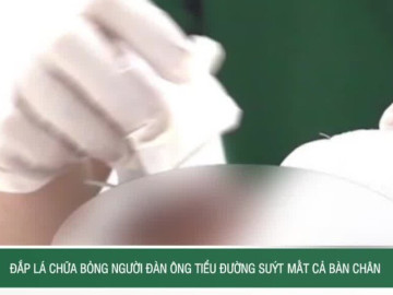 Đắp lá chữa bỏng, người đàn ông tiểu đường suýt mất cả bàn chân