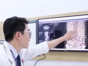 Người phụ nữ 55 tuổi gặp biến chứng nghiêm trọng vì để quên ống thông tiểu JJ